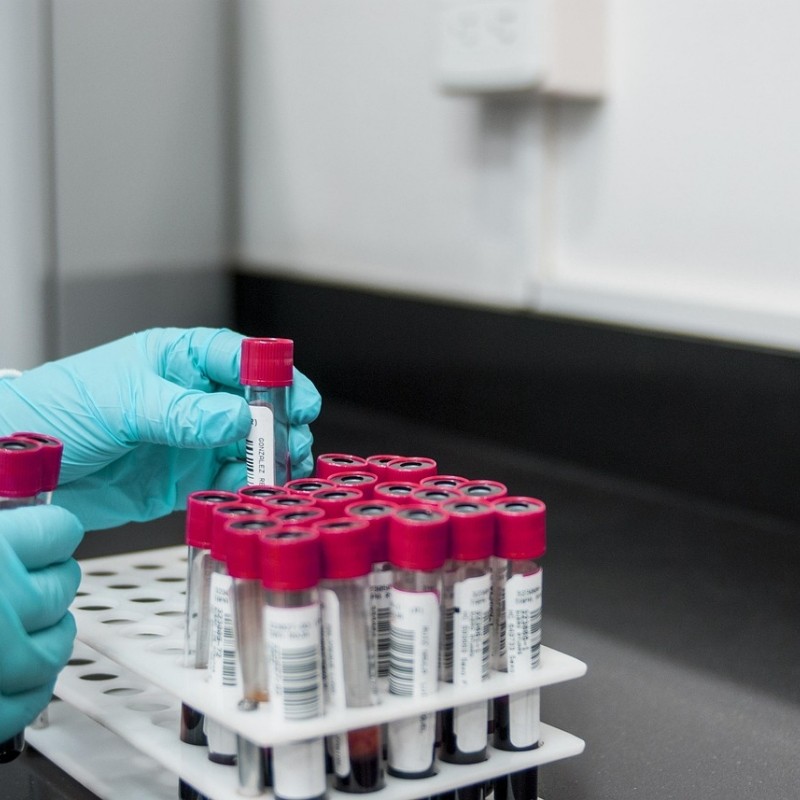 O que torna um bom fabricante de suprimentos de laboratório na China?