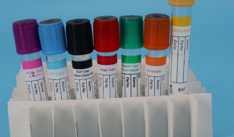 specimen tubes
