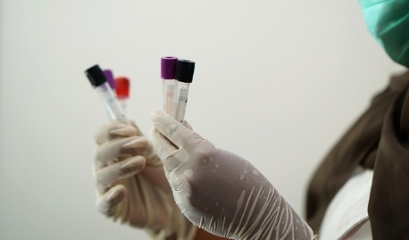 Embalagem e transporte de bancos de amostras biológicas